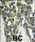GBL Antibody (Center)