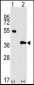 GBL Antibody (Center)