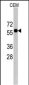 CNOT4 Antibody (C-term)