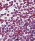 Cdc25A Antibody (Center)