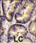 VEGFB (VEGF2) Antibody (Center)