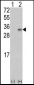 VEGFB (VEGF2) Antibody (Center)