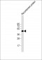 H1L Antibody