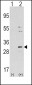 NNMT Antibody (Center)