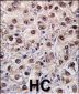 PEMT Antibody (N-term)