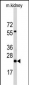 PEMT Antibody (N-term)