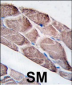 EPM2A Antibody (C-term)