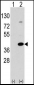 EPM2A Antibody (C-term)