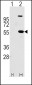 ALDH1A1 Antibody (Center)