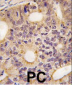 Latexin Antibody (N-term)