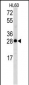 Latexin Antibody (N-term)