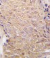 ALDH6A1 Antibody (N-term)