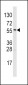 ALDH6A1 Antibody (N-term)