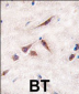 ERAS Antibody (N-term)