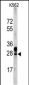 ERAS Antibody (N-term)