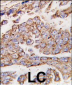 LAMP1 Antibody (N-term)