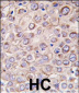 DRAM Antibody (N-term)