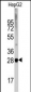 DRAM Antibody (N-term)