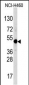 TFAP2A Antibody (C-term)