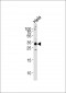 RPS6 Antibody (N-term)