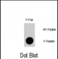 Phospho-Gab1(Y659) Antibody