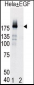 Phospho-EGFR(Y998) Antibody