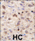 ZBTB7B Antibody (Center)