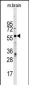 ZBTB7B Antibody (Center)