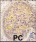CAMKK2 Antibody (N-term G67)