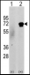 CAMKK2 Antibody (N-term G67)