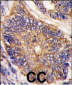ARH (LDLRAP1) Antibody (N-term)
