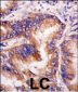 HRI (EIF2AK1) Antibody (Center)
