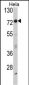 HRI (EIF2AK1) Antibody (Center)