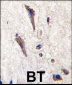 SPRED1 Antibody (N-term)