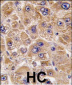 ALDH5A1 Antibody (C-term)