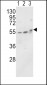 Alkaline Phosphatase (ALPL) Antibody (N-term)