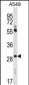 Claudin 1 (CLDN1) Antibody (Loop1)