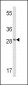 FXN Antibody (Center)