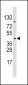 PDK4 Antibody (E265)