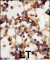 Rictor Antibody (N-term)