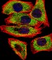 Transglutaminase (TGM2) Antibody (Center K444)