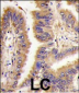 Transglutaminase (TGM2) Antibody (Center K444)