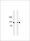 Transglutaminase (TGM2) Antibody (Center K444)