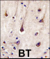 PIK3R2 Antibody (Y467)