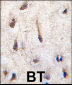 ERAS Antibody (N-term) (F66)