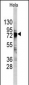 DDX3 Antibody (C-term)