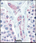 LIN28B Antibody (N-term)