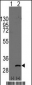 ASCL1 (Achaete-scute homolog 1) Antibody (C-term D220)