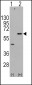 AKT3 Antibody (S472)