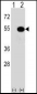 PRAK (MAPKAPK5) Antibody (T182)